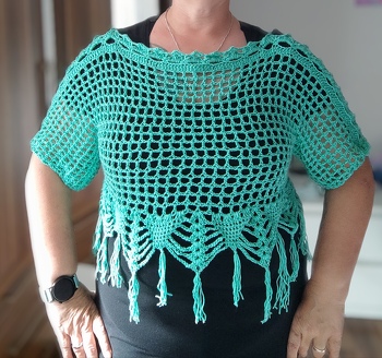 Alles super, tolles Ergebnis. Endlich kann ich wieder meine ärmellosen Kleider tragen.