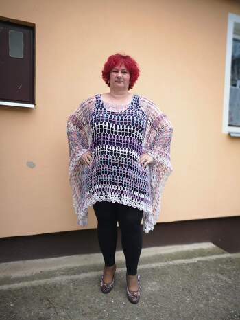 Geht schnell von der Nadel. Ich empfhele es.